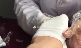 包扎伤口在线观看,在线教程助您掌握急救技能