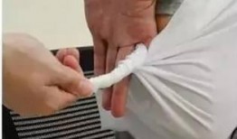 包扎伤口在线观看,在线教程助您掌握急救技能